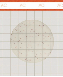 Aerobic Count Plate