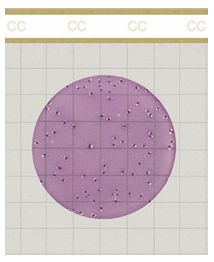 Coliform Count Plate