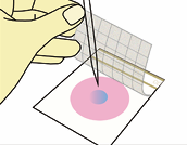 Inoculation